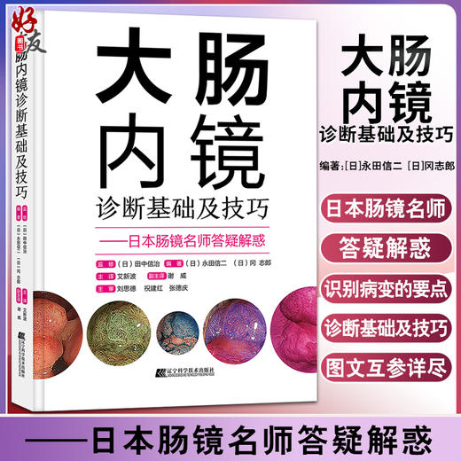 大肠内镜诊断基础及技巧 日本肠镜名师答疑解惑 提高大肠病变的诊断水平 永田信二 冈志郎 编著 9787559118516 辽宁科学技术出版社 商品图0