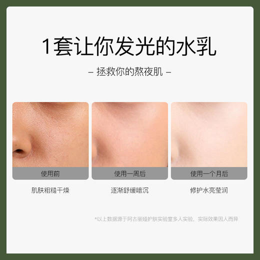 【超值装】阿古丽娅白松露水乳套装学生党平价爽肤水收缩毛孔补水保湿乳液 商品图2