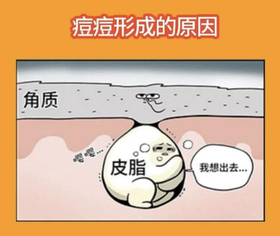 不同的痘痘要怎么处理？