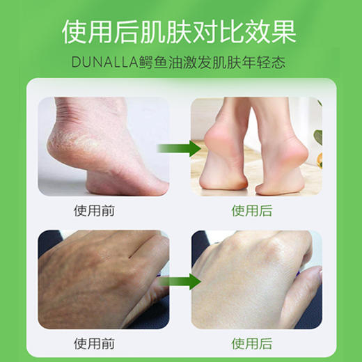 加赠1瓶 | dunalla多用鳄鱼油保湿修复冻疮膏 防干裂冻伤25g*2瓶 [福利品] 商品图7