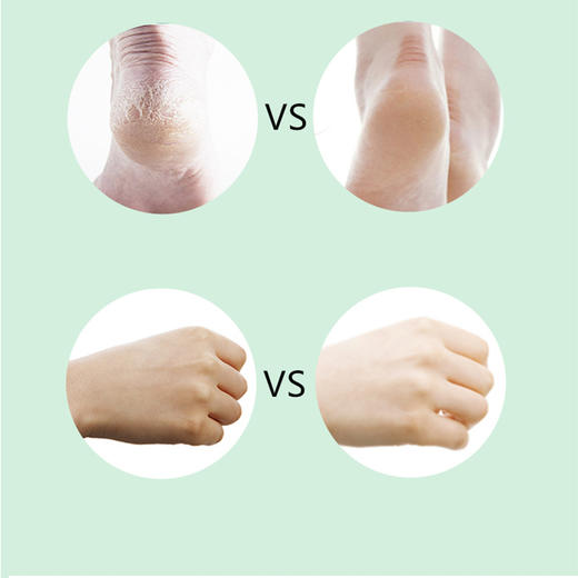 加赠1瓶 | dunalla多用鳄鱼油保湿修复冻疮膏 防干裂冻伤25g*2瓶 [福利品] 商品图5