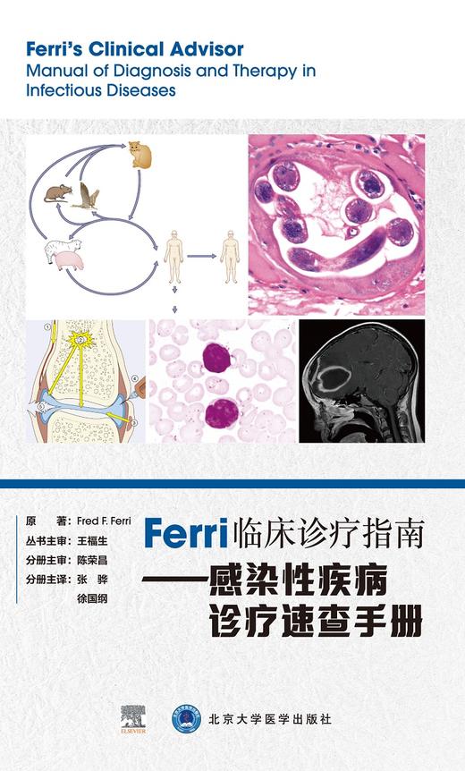 Ferri临床诊疗指南 感染性疾病诊疗速查手册 详述988种医学障碍和疾病 弗雷德·费里 原著 9787565925085 北京大学医学出版社 商品图2
