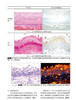 胃与肠 放大内镜诊断食管黏膜癌 验证食管学会分类 消化道形态学诊断为中心 结合内外科及病理 辽宁科学技术出版社9787559120748 商品缩略图3