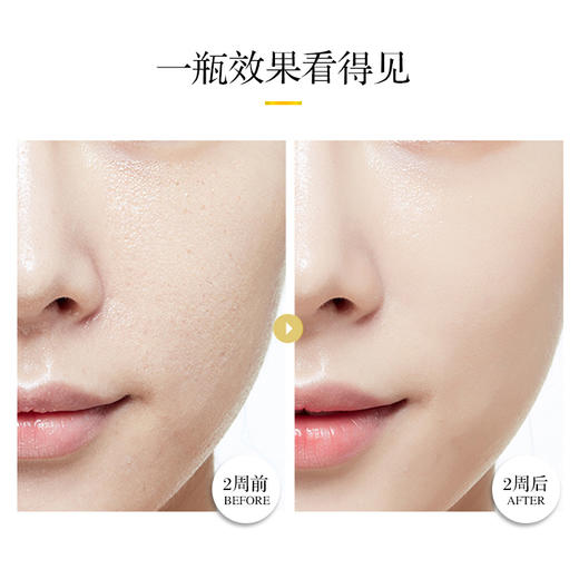 「赋活修护 愈见年轻光彩」抗皱修护 山茶花润肤油 提拉修护 淡化眼部细纹 紧实肌肤 提亮肤色 抗氧化  滋润保湿 高活性 10ml/瓶 商品图3