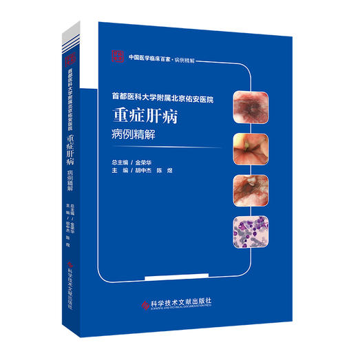 首都医科大学附属北京佑安医院重症肝病病例精解 中国医学临床百家病例精解 胡中杰 陈煜 科学技术文献出版社9787518976393 商品图1