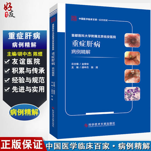首都医科大学附属北京佑安医院重症肝病病例精解 中国医学临床百家病例精解 胡中杰 陈煜 科学技术文献出版社9787518976393 商品图0