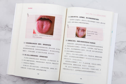 罗大伦：《图解舌诊》全新修订升级版 商品图3