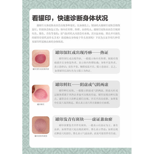 零基础学拔罐：视频版 商品图3