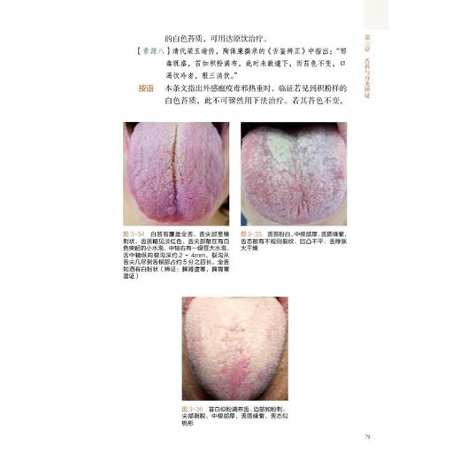 图解舌诊临证实录 商品图3