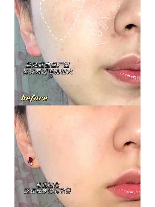 美蒂菲玫瑰软膜补水精华粉冰淇淋medipeel面膜 商品图3