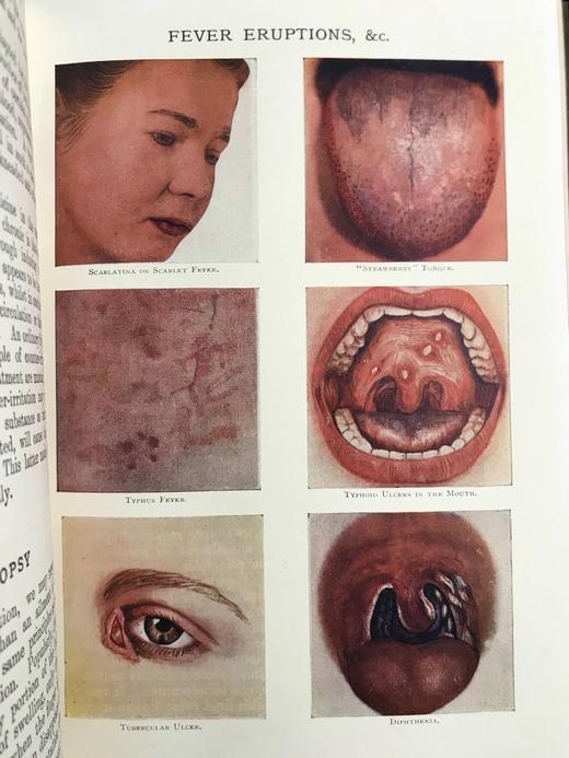 医学经典约20世纪早期 现代医生指南（全5卷） 3组彩色多层图与数百幅黑白插图 漆布精装18开 商品图11