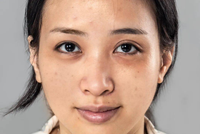 女性肝气郁结有5种明显症状 需怎么调理