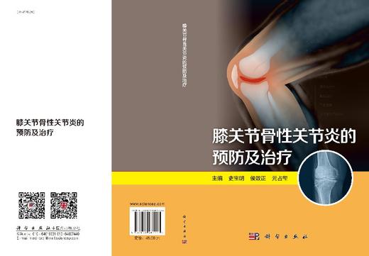 [按需印刷]膝关节骨性关节炎的预防及治疗/史宝明，侯效正，元占玺 商品图3