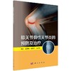 [按需印刷]膝关节骨性关节炎的预防及治疗/史宝明，侯效正，元占玺 商品缩略图0