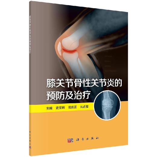 [按需印刷]膝关节骨性关节炎的预防及治疗/史宝明，侯效正，元占玺 商品图0