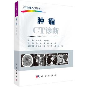 [按需印刷]肿瘤CT诊断/李琳，董越，石磊
