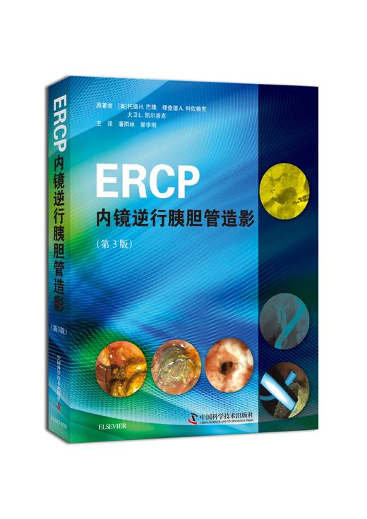 ERCP内镜逆行胰胆管造影 商品图0
