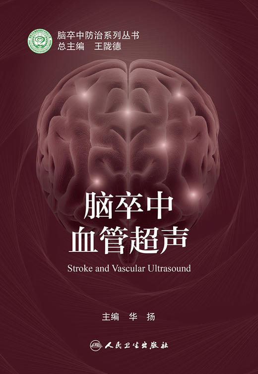 脑卒中血管超声 商品图1