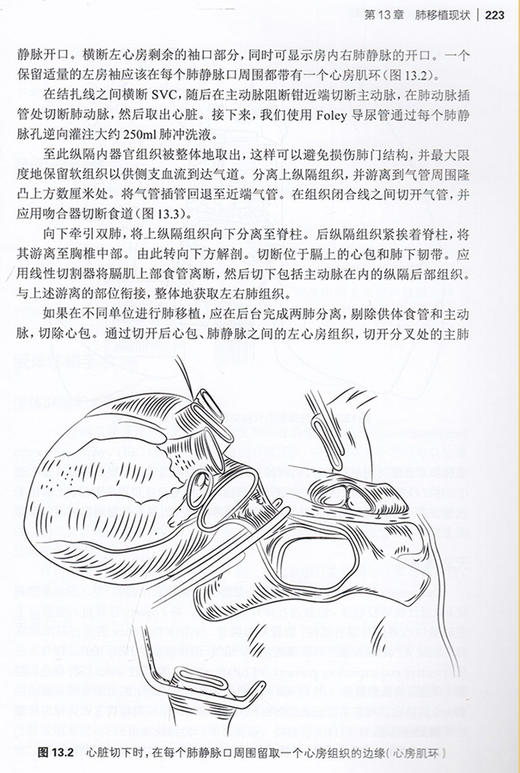 心脏外科核心理论与实践 大卫塔格特 主编 心外科学书籍 心脏疾病治疗技术参考书临床实践手术操作 人民卫生出版社9787117322782 商品图4