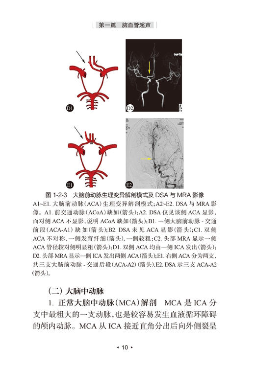 脑卒中血管超声 脑卒中防x治系列丛书 华扬 主编 神经内科学书籍 血管超声评估临床诊疗检查 人民卫生出版社9787117322805 商品图4