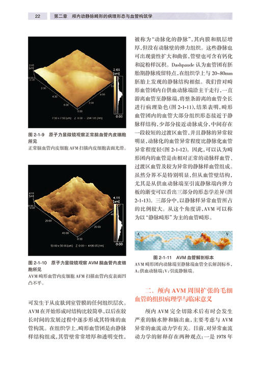 颅内动静脉畸形 陈光忠 段传志 王东海 主编 神经外科学书籍 血管构筑 影像学诊断临床治疗 人民卫生出版社9787117324090 商品图4