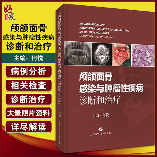 颅颌面骨感染与肿瘤性疾病诊断和治疗 何悦 口腔科学书籍 颅颌面骨常见病检查诊疗手术操作 上海科学技术出版社9787547854884 商品图0