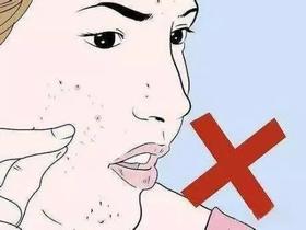  护肤科普 | 痘痘里面挤出来的到底是什么？痘痘怎样好得快？ 