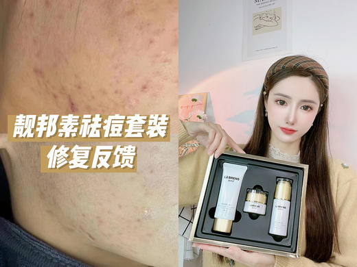 【靓邦素】美白祛痘修护三件套 商品图3