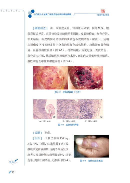 山西医科大学第二医院皮肤性病科病例精解 中国医学临床百家病例精解 冯文莉皮肤性病学书籍科学技术文献出版社9787518977925 商品图3