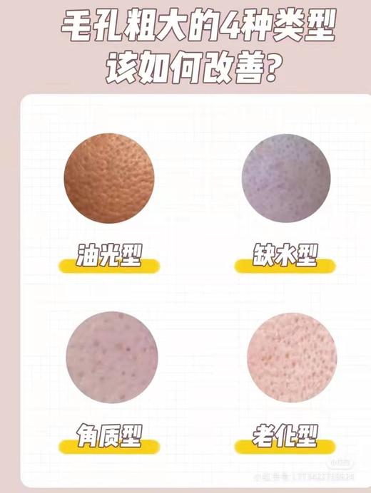 毛孔粗大的4种类型 商品图0