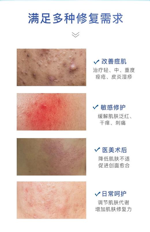 芙清经典白膜 商品图7