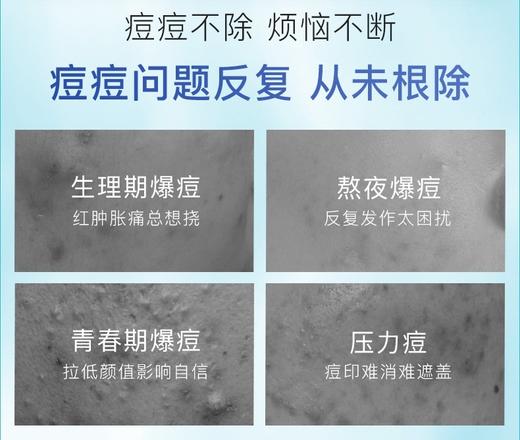 芙清经典白膜 商品图4