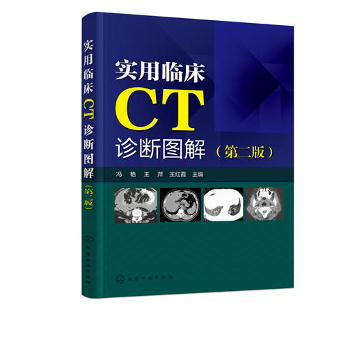 正版 实用临床CT诊断图解 第二版 冯艳 临床医学影像学医学诊断学书籍 临床医师畅销书籍 医学影像书籍 CT诊断用书 CT读片指南书籍 化学工业出版社 9787122322791 商品图1