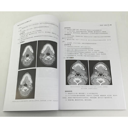 正版 实用临床CT诊断图解 第二版 冯艳 临床医学影像学医学诊断学书籍 临床医师畅销书籍 医学影像书籍 CT诊断用书 CT读片指南书籍 化学工业出版社 9787122322791 商品图4