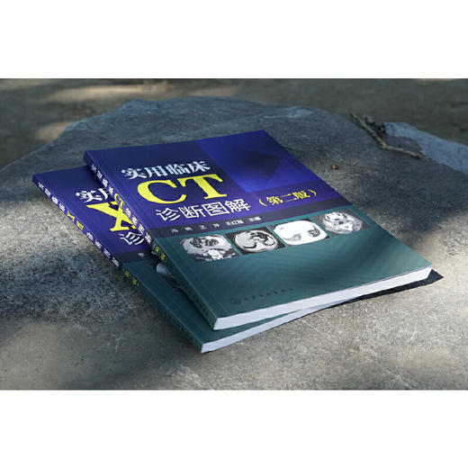 正版 实用临床CT诊断图解 第二版 冯艳 临床医学影像学医学诊断学书籍 临床医师畅销书籍 医学影像书籍 CT诊断用书 CT读片指南书籍 化学工业出版社 9787122322791 商品图3