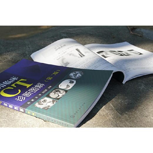 正版 实用临床CT诊断图解 第二版 冯艳 临床医学影像学医学诊断学书籍 临床医师畅销书籍 医学影像书籍 CT诊断用书 CT读片指南书籍 化学工业出版社 9787122322791 商品图2