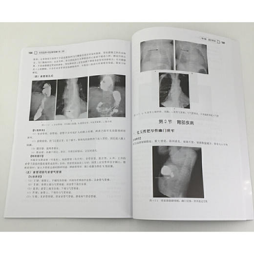 实用临床X线诊断图解 第二版 X线影像鉴别和诊断书 X线读片指南 医学影像学书籍 影像学诊断图谱 影像解剖学图解教材 临床医学书籍 化学工业出版社 9787122322784 商品图4