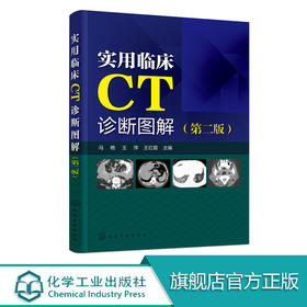 正版 实用临床CT诊断图解 第二版 冯艳 临床医学影像学医学诊断学书籍 临床医师畅销书籍 医学影像书籍 CT诊断用书 CT读片指南书籍 化学工业出版社 9787122322791
