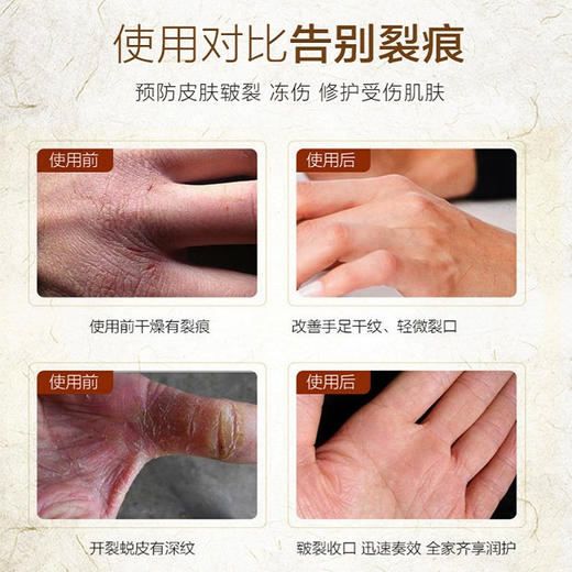 【预冻修疮二合一】防冻冷疮偏方  手指冰冻手足开裂  预防皲裂滋润修护  草本精华温和配方  持久滋润深层渗 商品图1