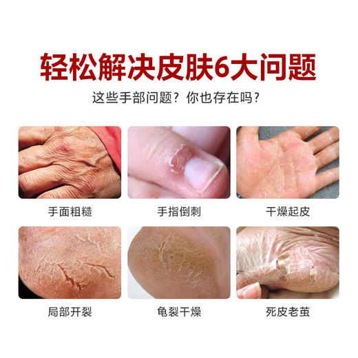 【买2送1，多买多送 干裂“克星”】呵护手足远离干裂深层滋润强韧肌肤软化角质天然温和蛇油成分北美金缕梅提取物蛇油愈裂膏 商品图2