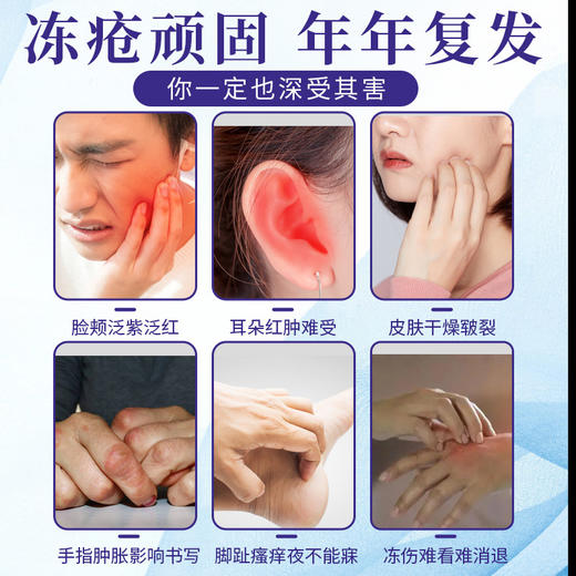 【买2送1】广东南方医学研究院 手足干裂皲裂膏 滋润保湿 30g/支 商品图1