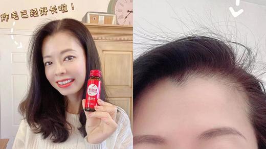 【中宁新鲜枸杞原浆】3盒装杞维康中宁枸杞原浆50ml*6瓶*3盒原产地直发能喝的“护肤品”，补气色，养肝肾，明目效果立竿见影！坚持喝告别亚健康！ 商品图11