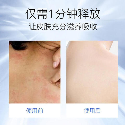 【和瘙痒说拜拜】BXF湿疹皮炎修护止痒喷雾天然成分温和不刺激 商品图2