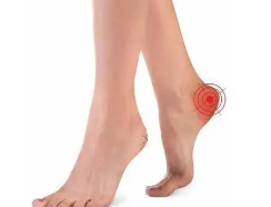 足跟痛是什么原因？看了这篇文章，你就知道了~ 