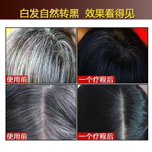 魅赞天然首何乌提取物黑亮养发固发洗发露（黑亮发质） 商品图7