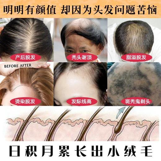 魅赞基础生姜防掉育发洗发水 商品图4