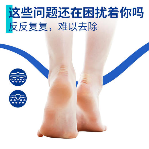 【买2送1】 科靓鸡眼护理液去除手部足部脚底脚趾疣根刺温和无痛可碰水不影响日常生活 商品图1