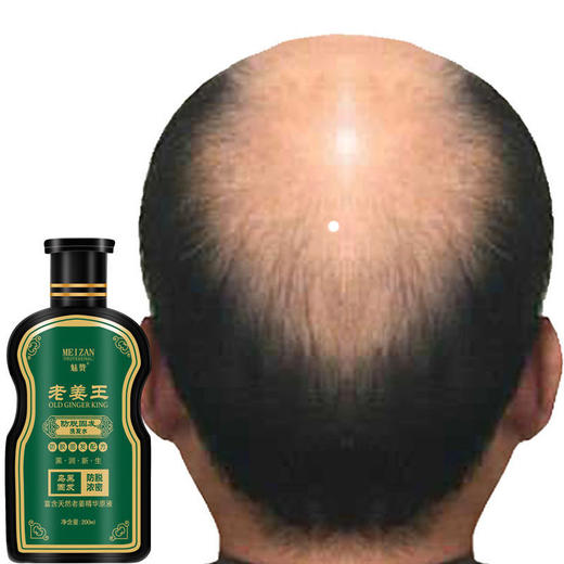 魅赞基础生姜防掉育发洗发水 商品图6