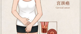  22 岁，得了宫颈癌！妇科医生忠告，这五类人最好定期检查！ 