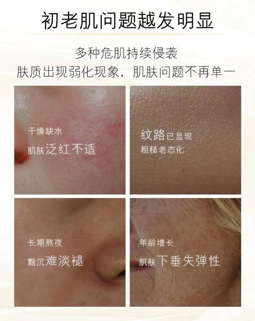 【贵妇级二裂酵母】澳莱莉二裂酵母护肤五件套补水保湿提亮改善细纹（洗面奶、爽肤水、乳液、面霜可单瓶购买） 商品图6